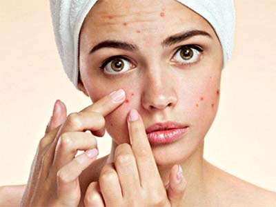 Sai lầm thường gặp khi trị mụn
