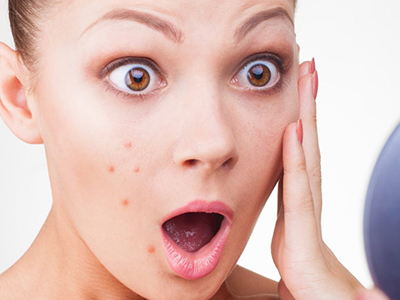 Bạn đã hiểu đúng về mụn đầu đen, sợi bã nhờn hay chưa?