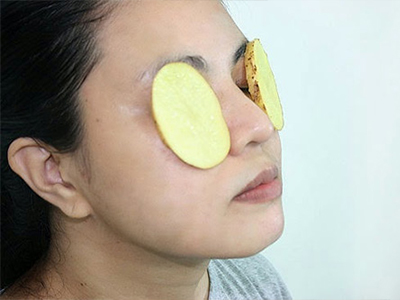Tự chế kem tắm trắng với khoai tây