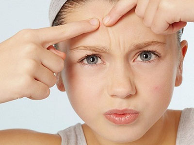Hậu quả trị mụn không đúng cách