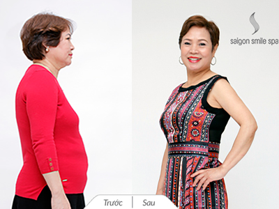 Chị Kim Liên từ Thuỵ Điển về Việt Nam giảm béo thành công