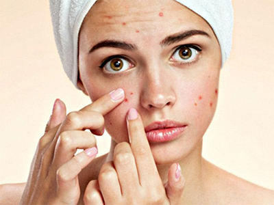 Các nguyên liệu trị mụn tại nhà