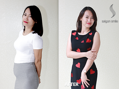 Cuộc cách mạng giảm béo của phụ nữ sau sinh