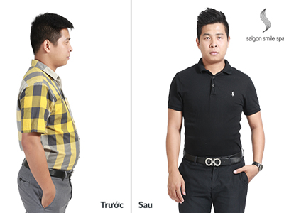 Người thật – việc thật: không thừa cân vẫn quyết tâm giảm béo