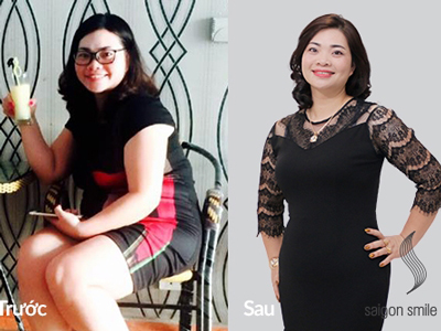 “Kê đơn” hợp cơ địa, nữ dược sĩ giảm vòng bụng 100 xuống còn 72
