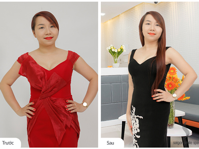 Nữ giảng viên giảm 10cm bụng sau 20 năm béo “bền vững”
