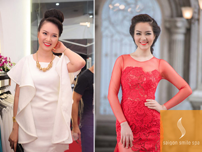 Cách rút gọn thời gian giảm béo