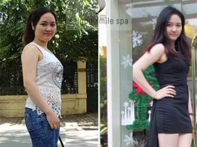 Giảm béo không chỉ cho người sau sinh