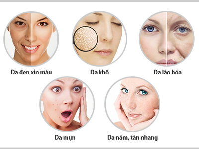 Làm trắng da chống lão hoá Yuki thích hợp cho những làn da nào?