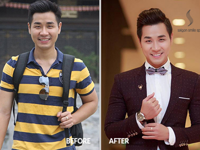 MC Nguyên Khang tút lại vẻ đẹp trai đón tết
