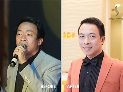 Lì xì hấp dẫn tới 40%