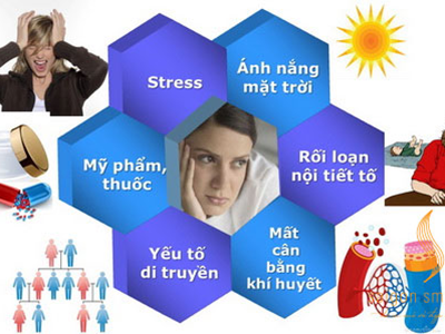 Trị nám không thể cam kết lâu dài