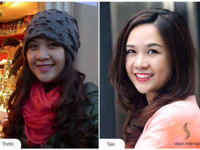 Giải mã nữ MC 32 tuổi da không đen vẫn cần làm trắng