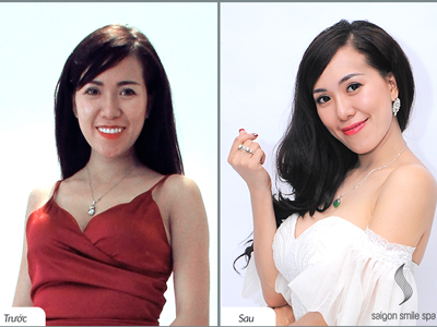 Không cần cấy phấn, bà mẹ Mai Thỏ trắng bật 3 tone da