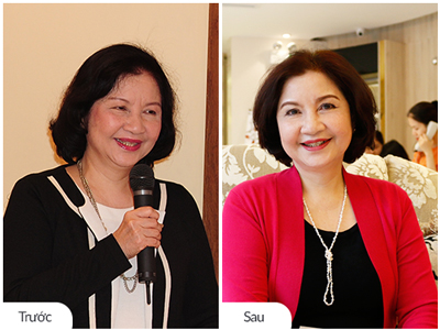 300 thẻ làm đẹp đa năng trị giá lên tới 2 tỷ đồng từ Saigon Smile Spa