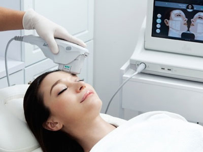 Căng da mặt hiệu quả không cần phẫu thuật nhờ Ultherapy