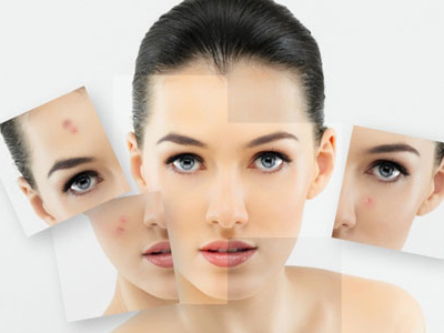 Trị mụn trứng cá