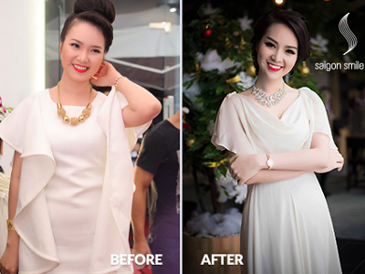 Hành trình 3 năm giảm béo của Á Hậu Thuỵ Vân