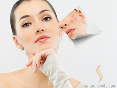 Hết sạch mụn không lo về giá khi làm đẹp tại Saigon Smile Spa