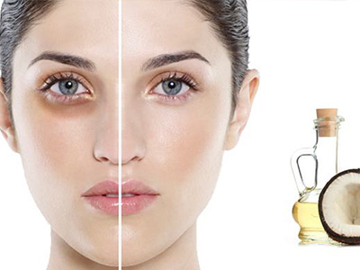1 Nghìn đồng trị nám hiệu quả như 1 triệu đồng