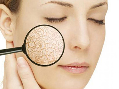 3 Cách trị nám da được tin tưởng nhất mùa thu này