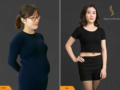 Nặng tới 90kg sau sinh, bà mẹ 9X quyết giảm 30kg trước hết