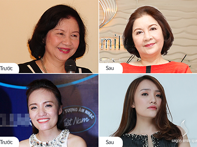 Sạch tàn nhang, hết sụp mí, căng bóng da chỉ 1 lần kịp đón tết