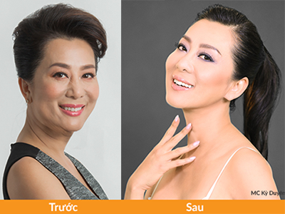 Lợi ích kép của việc kết hợp bộ đôi trẻ hoá da ultherapy và thermage