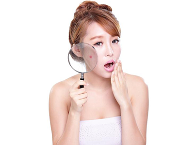 Trị mụn cấp tốc cho da trắng mịn tự nhiên