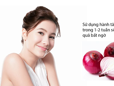 Trị nám mùa hè, mẹo hay nên thực hiện ngay