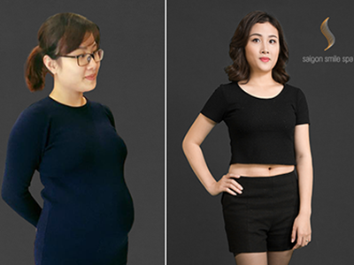 Mẹ bỉm sữa giảm 30kg không phẫu thuật dù chồng là bác sĩ PTTM