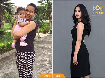 Giảm 22cm bụng, nữ giáo viên Yoga bỏ tủ đồ size XXL thành size S