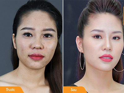 Da căng bóng, se khít lỗ chân lông, xóa mờ nếp nhăn nông