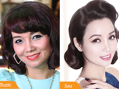 Là phẳng nếp nhăn, tiêu mỡ mặt, tan nọng cằm theo cách của Sao