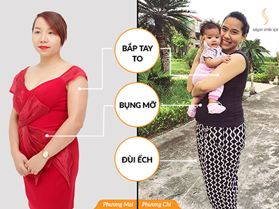 Bụng mỡ, bắp tay to, đùi ếch bất ngờ giảm sau 10 ngày