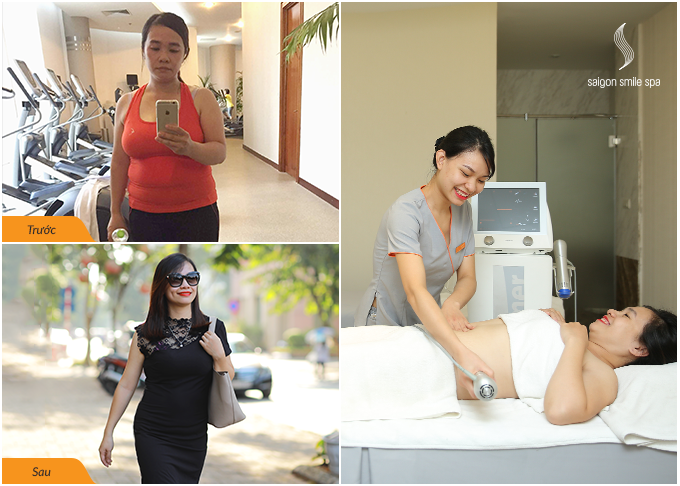 Giảm 5-8kg nhanh chóng nhờ phương pháp của bác sỹ mỹ