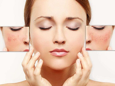 Trị nám chân sâu, bạn đã biết cách chưa?