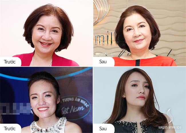 Mẹ chồng u70 mỹ linh, ca sỹ nhật thủy livestream trẻ hóa da