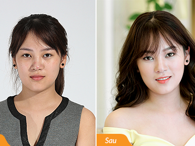 Chuyên gia chỉ cách thoát da khô mốc, trắng bóng lại mờ nhăn