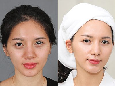 Da căng bóng, hết đốm nâu, trẻ hoá da dịp trước tết