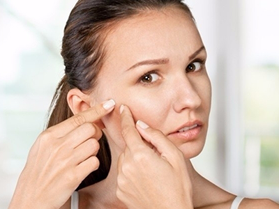 Trị mụn tự nhiên, bạn đã biết cách chưa?