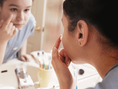 Trị mụn mờ thâm – da trắng sáng, mịn màng như ý