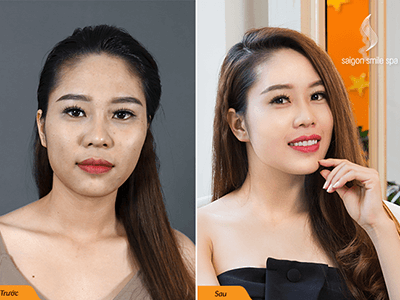 Làm đẹp da mùa Tết với 90 phút trị liệu trắng hồng 360 độ