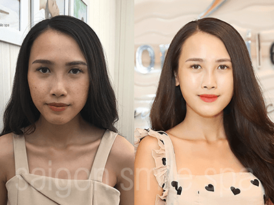 Làn da bao công hóa bạch tuyết không hề khó!