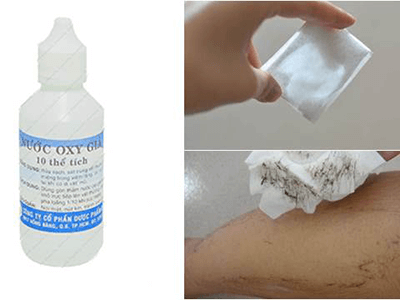 Tuyệt chiêu tẩy lông tay vừa đơn giản lại hiệu quả, cho da trắng mịn tự nhiên