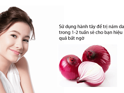Trị nám sau sinh cực hiệu quả và đơn giản