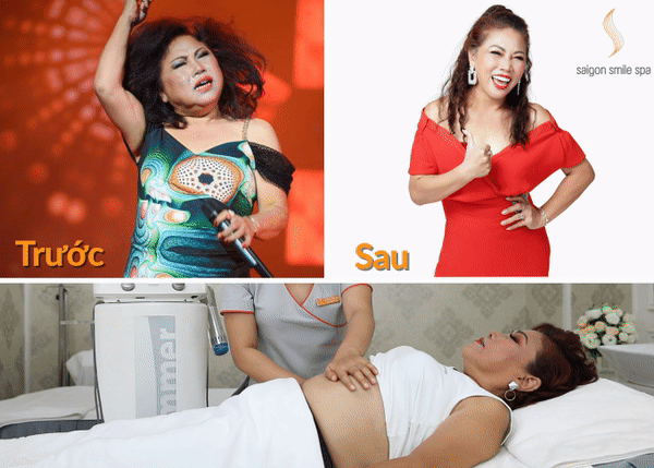 Giảm béo trung niên tại sao luôn khó hơn độ tuổi khác