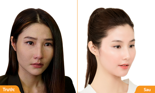 Diễm My: ‘Làn da là hiện thân của sức khỏe, sắc đẹp và sinh lý người phụ nữ’