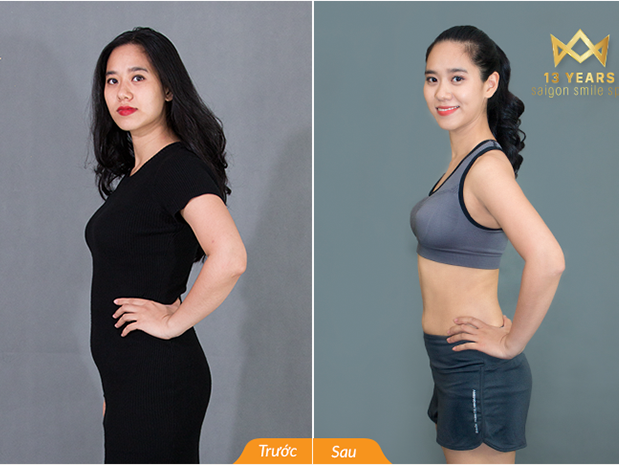 [REVIEW] 6 tiêu chí đánh giá spa điều trị nám hiệu quả nhất năm 2022
