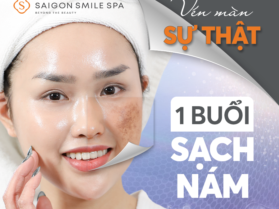 Bí quyết lấy lại tự tin cho gen Z bị nám bẩm sinh